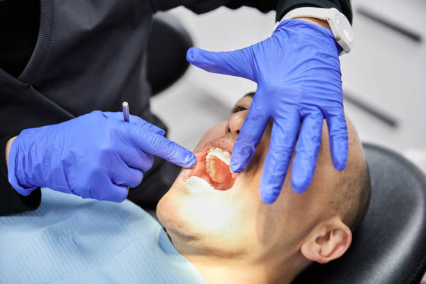 Best Emergency Dental Care for Broken or Chipped Teeth in Harwich Center, MA
